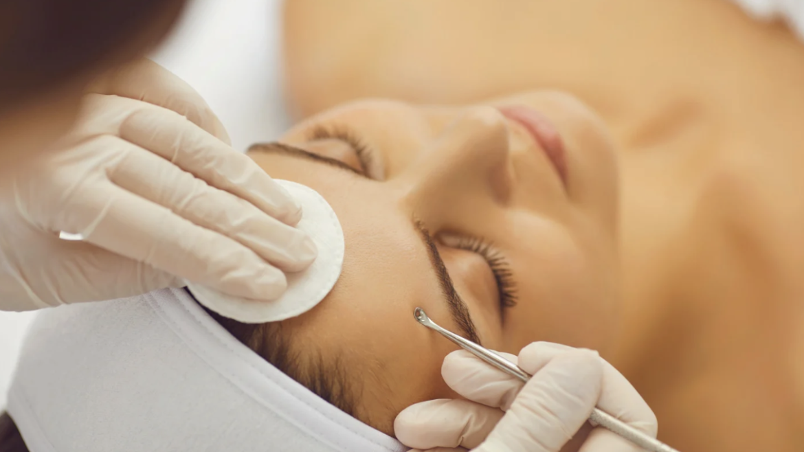 Top Acne Treatment Clinic Near Falls Church for Clearer Skin